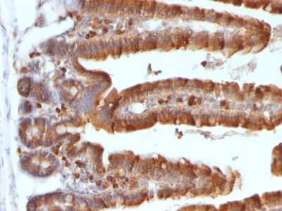 Immunohistochemistry-Paraffin: Ornithine Decarboxylase Antibody (ODC1/487) [NBP2-44735]