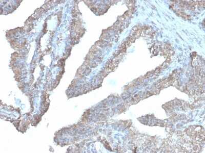 Immunohistochemistry-Paraffin: Ornithine Decarboxylase Antibody (rODC1/485) [NBP3-07463]