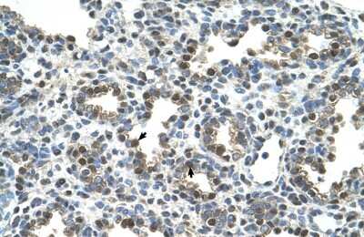 Immunohistochemistry: Osteoactivin/GPNMB Antibody [NBP1-69389]