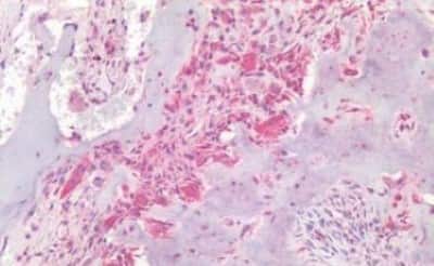 Immunohistochemistry-Paraffin: Osteocalcin Antibody [NBP3-14434]