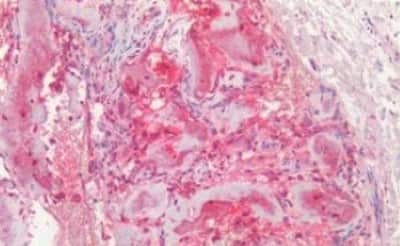Immunohistochemistry-Paraffin: Osteocalcin Antibody [NBP3-14435]