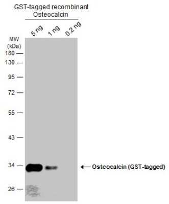 Western Blot: Osteocalcin Antibody [NBP3-13133]