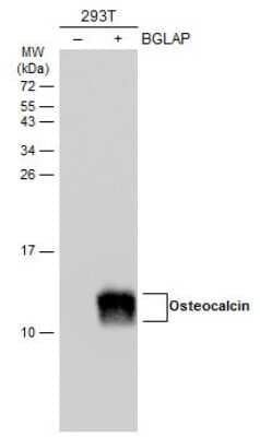 Western Blot: Osteocalcin Antibody [NBP3-13133]