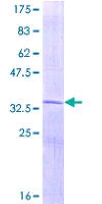 SDS-PAGE: Recombinant Human Osteocalcin GST (N-Term) Protein [H00000632-P01]