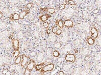 Immunohistochemistry-Paraffin: Osteopontin/OPN Antibody (001) [NBP2-89443]