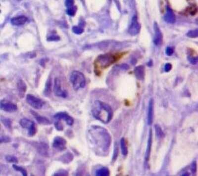 Immunohistochemistry: Osteopontin/OPN Antibody (1B20) - BSA Free [NB110-89062]