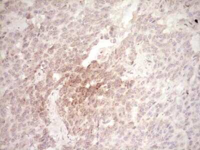 Immunohistochemistry: Osteopontin/OPN Antibody (OTI5E4) [NBP2-45954]