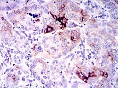 Immunohistochemistry-Paraffin: Osteopontin/OPN Antibody (7C5H12) - BSA Free [NBP2-37423]