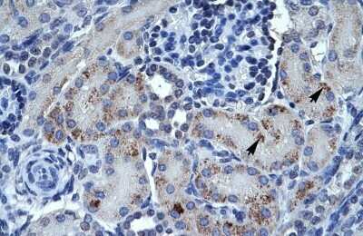 Immunohistochemistry-Paraffin: Osteopontin/OPN Antibody [NBP1-59190]