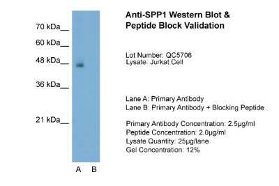 Western Blot: Osteopontin/OPN Antibody [NBP1-59190]
