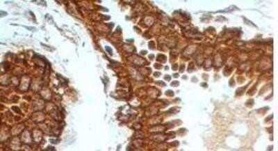 Immunohistochemistry: Osteoprotegerin/TNFRSF11B Antibody (98A1071) - Azide Free [NBP2-33211]