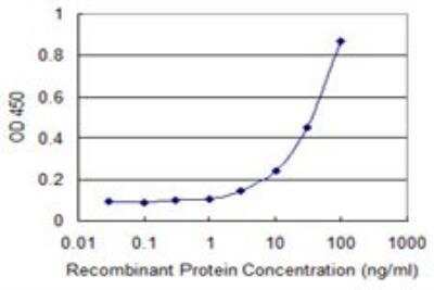 ELISA: Otubain-1 Antibody (1C12) [H00055611-M09]