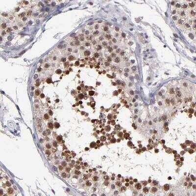 Immunohistochemistry-Paraffin: Otubain-2 Antibody [NBP1-88410]
