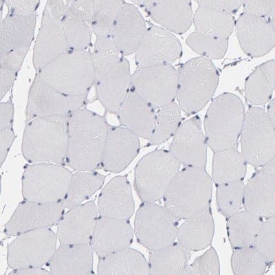 Immunohistochemistry-Paraffin: Otubain-2 Antibody [NBP1-88410]