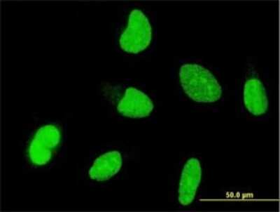 Immunocytochemistry/ Immunofluorescence: Otx1 Antibody (1F2) [H00005013-M01]