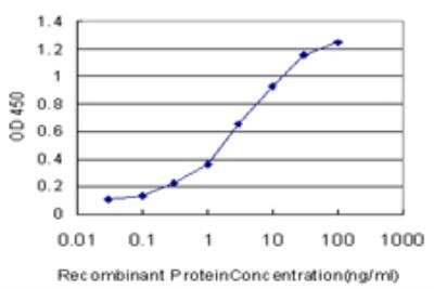 ELISA: Otx1 Antibody (3A5) [H00005013-M07]