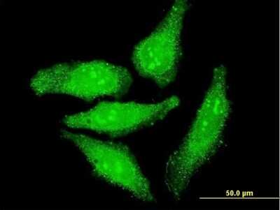 Immunocytochemistry/ Immunofluorescence: Otx1 Antibody (3A5) [H00005013-M07]