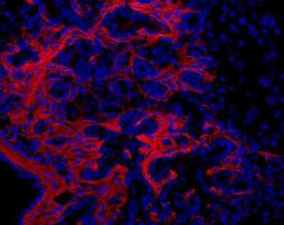 Immunohistochemistry: Oval Cell Marker Antibody (OC2-1C6) [NBP1-18965]