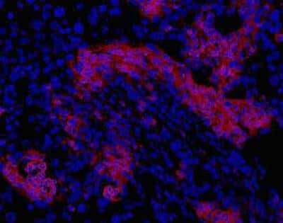 Immunohistochemistry: Oval Cell Marker Antibody (OC2-2A6) [NBP1-18967]