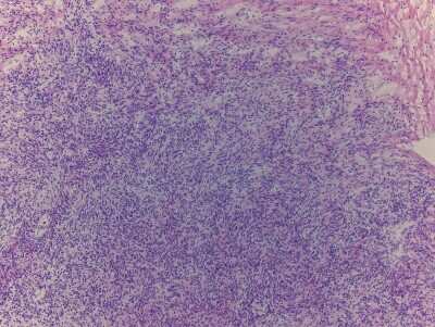 Hematoxylin & Eosin Stain: Ovary Tissue Slides (Adult Normal)- Frozen [NBP2-77580]