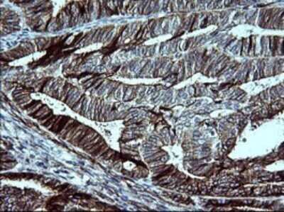 Immunohistochemistry: P-Cadherin Antibody (OTI2D5) [NBP2-45601]
