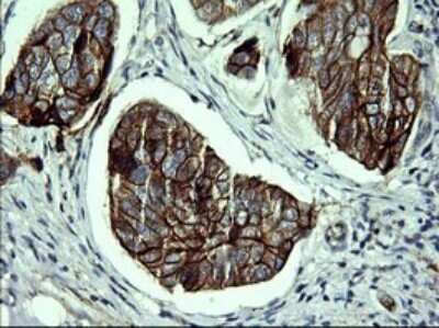 Immunohistochemistry: P-Cadherin Antibody (OTI2D5) [NBP2-45601]