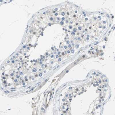 Immunohistochemistry-Paraffin: P-Selectin/CD62P Antibody [NBP1-85744]