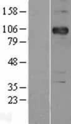 Western Blot: P-Cadherin Overexpression Lysate [NBL1-09032]