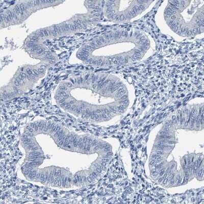 Immunohistochemistry-Paraffin: P11 Antibody [NBP1-82458]