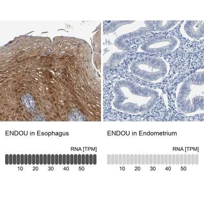 Immunohistochemistry-Paraffin: P11 Antibody [NBP1-82458]
