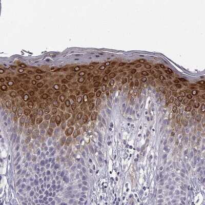 Immunohistochemistry-Paraffin: P11 Antibody [NBP2-55877]