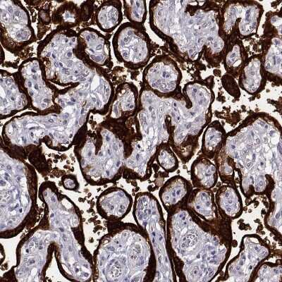 Immunohistochemistry-Paraffin: P11 Antibody [NBP2-55877]