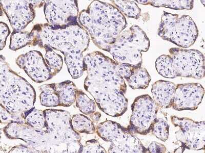 Immunohistochemistry-Paraffin: P11 Antibody [NBP2-99471]