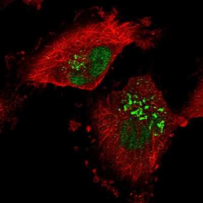 Immunocytochemistry/ Immunofluorescence: P15RS Antibody [NBP1-87917]