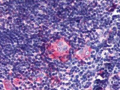 Immunohistochemistry-Paraffin: LPAR6/P2RY5 Antibody - BSA Free [NLS850]