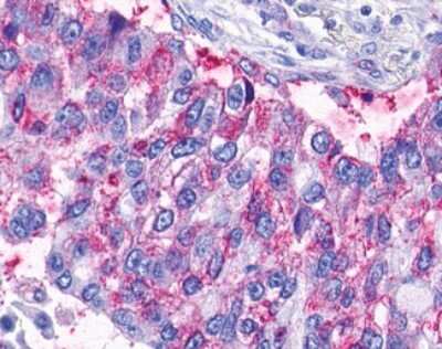 Immunohistochemistry-Paraffin: LPAR6/P2RY5 Antibody - BSA Free [NLS850]