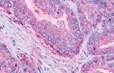 Immunohistochemistry-Paraffin: LPAR6/P2RY5 Antibody - BSA Free [NLS850]