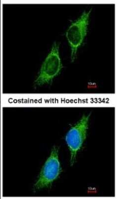 Immunocytochemistry/ Immunofluorescence: P2X2/P2RX2 Antibody [NBP2-19655]