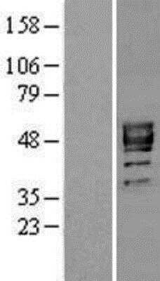 Western Blot: P2X3/P2RX3 Overexpression Lysate [NBL1-14030]