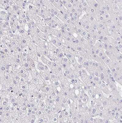 Immunohistochemistry-Paraffin: P2X3/P2RX3 Antibody [NBP2-33848]