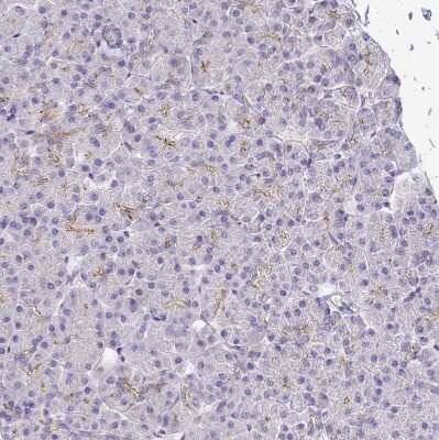 Immunohistochemistry-Paraffin: P2X3/P2RX3 Antibody [NBP2-33848]