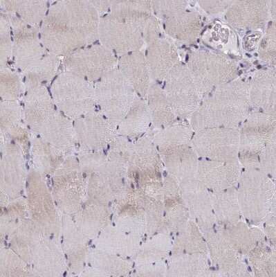 Immunohistochemistry-Paraffin: P2X3/P2RX3 Antibody [NBP2-33848]