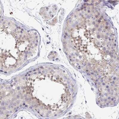 Immunohistochemistry-Paraffin: P2X3/P2RX3 Antibody [NBP2-33848]