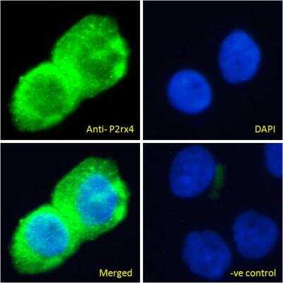 Immunocytochemistry/ Immunofluorescence: P2X4 Antibody [NBP2-27567]
