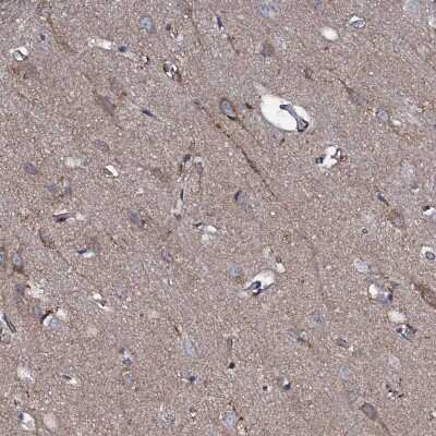 Immunohistochemistry-Paraffin: P2X4 Antibody [NBP1-92239]