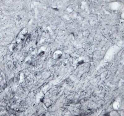 Immunohistochemistry Free-Floating: P2X6/P2RX6 Antibody - Azide and BSA Free [NBP1-30565]