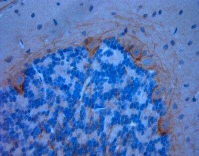 Immunohistochemistry-Paraffin: P2X7/P2RX7 Antibody [NBP1-20180]