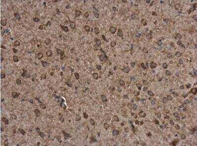 Immunohistochemistry-Paraffin: P2X7/P2RX7 Antibody [NBP1-32470]