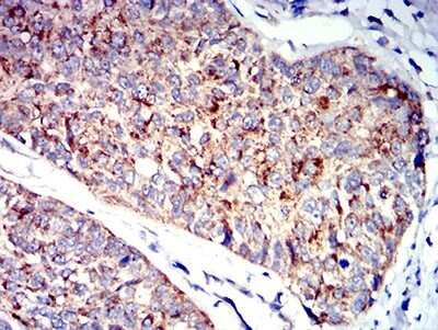 Immunohistochemistry-Paraffin: P2Y1/P2RY1 Antibody (4G5B7) - BSA Free [NBP2-61671]