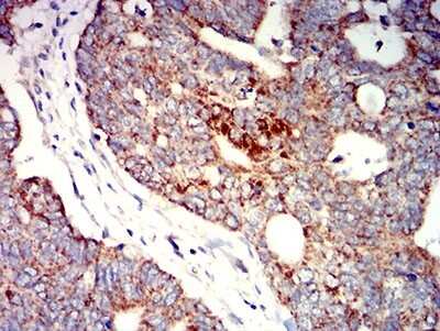 Immunohistochemistry-Paraffin: P2Y1/P2RY1 Antibody (4G5B7) - BSA Free [NBP2-61671]